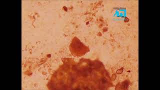 Larvas y huevos de ancylostomas en heces de perro [upl. by Marlon446]