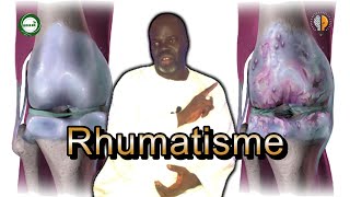 1  Rhumatisme Symptômes et Causes  Pr Ousmane Ndiaye  SAMA XALAAT TV [upl. by Gunar]