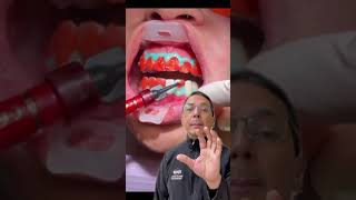 NEW Teeth Whitening InOffice Procedure Explained  In Office to Hands On Dental Training [upl. by Atikcir942]