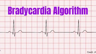 Bradycardia Algorithm [upl. by Rabaj]