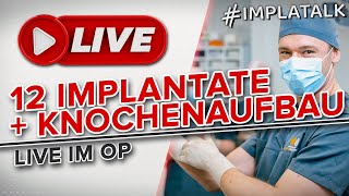 Tiefer Einblick So werden 12 Zahnimplantate mit Sinuslift gesetzt LIVE OP [upl. by Rundgren]