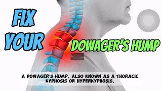 Fix Your dowager’s hump  Poor Posture  Desk job  ​⁠PhysiofitByDrMajid [upl. by Notnert899]