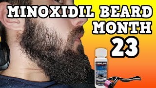 Minoxidil Beard Growth Results  Month 23  TheJourneyContinues [upl. by Eillod854]