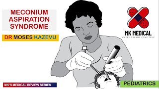 Meconium Aspiration Syndrome  MAS [upl. by Anette151]