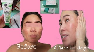 Pigmanorm and Facial Wash Review  Pangtanggal NG Pikas o Melasma  Ate Marian [upl. by Saberhagen]