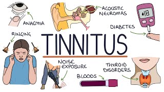 Understanding the Causes of Tinnitus [upl. by Naujat]