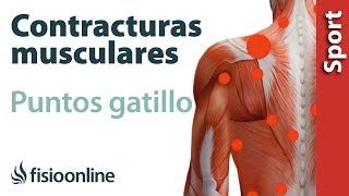 3 cosas que debes saber sobre las contracturas musculares y los puntos gatillo [upl. by Eeryt825]