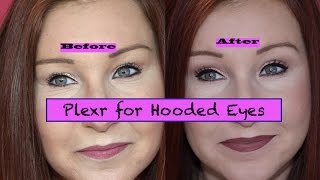 Plexr Plasma Fibroblast Treatment for Hooded Eyes  Part 3  Results Non surgical Blepharoplasty [upl. by Rubbico220]