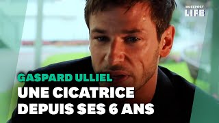 Gaspard Ulliel et sa cicatrice lhistoire derrière cette marque qui faisait quotpartie de luiquot [upl. by Orban548]