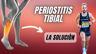 ❌ Descubre Cómo ELIMINAR la PERIOSTITIS TIBIAL FUNCIONA ✅ [upl. by Haldan]