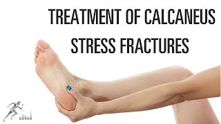 How do you treat a calcaneus stress fracture [upl. by Idnam]