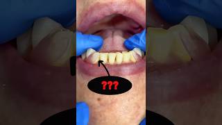 DID YOU KNOW that flexible dental prostheses exist music amongus beats animation art mrdent [upl. by Burnham]