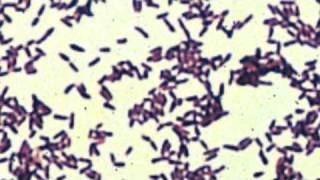 corynebacterium [upl. by Vassell]