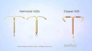 What is an IUD [upl. by Harvison]