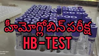 Hb test Labsrinath youtubevideos [upl. by Airotnahs]