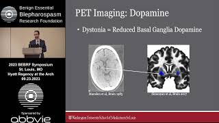 Multimodal Neuroimaging of Molecular amp Brain Network Dysfunction in Dystonia [upl. by Todd]