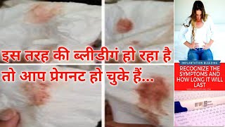 Implantation bleeding vs periods।।इम्प्लांटेशन ब्लीडिंग क्या है कब होती है कितने दिन तक होती है। [upl. by Yendirb]