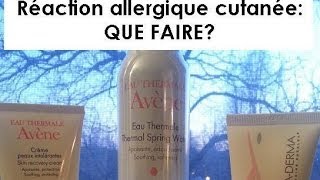 Réaction allergique cutanée Que faire [upl. by Kass504]