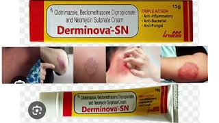 Derminova SN Cream Clotrimazole Beclomethasone Dipropionate and Neomycin Sulphate Cream [upl. by Aistek450]