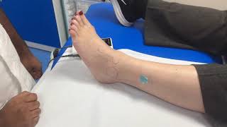 How to check for the peroneal artery pulse with a Doppler [upl. by Nanyk]