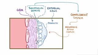 Membranous Glomerulonephritis  Renal Pathology  Osmosis [upl. by Sayer107]