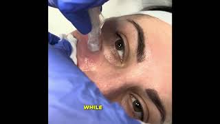 WHY Wednesday  Microneedling with AnteAGE MD Growth Factors and Cytokines [upl. by Jania]