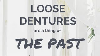 LOOSE DENTURES are a thing OF THE PAST [upl. by Adnara]