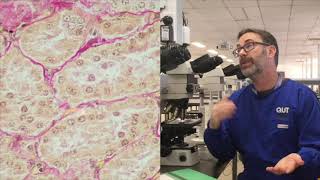 Microscope tutorial  Troubleshooting the Van Gieson stain [upl. by Helprin915]