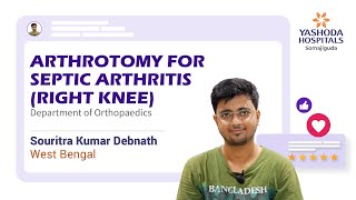 Arthrotomy for Septic Arthritis Right Knee Yashoda Hospitals Hyderabad [upl. by Dawson]