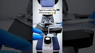 Sperm under the microscope 😦 🔬viralvideo microscope shortfeed animals shorts reels [upl. by Eirolav]