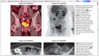 GYNAE IMAGING DIAGNOSTIC IMAGING SERIES [upl. by Brottman]