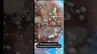 MICROORGANISM GROWTH IN PETRIDISH dmltscience medical microbiology BLOOD AGAR CHOCHLATE AGAR [upl. by Dlonyar]