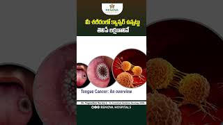 Symptoms of Throat Cancer in Telugu  Signs of Cancer  Renova Hospitals  shorts throatcancer [upl. by Romano]