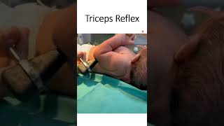 Triceps Reflex [upl. by Rubbico]