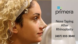 How To Tape Your Nose After Rhinoplasty Nose Job  Orlando Plastic Surgeon Dr Edward J Gross [upl. by Novia]