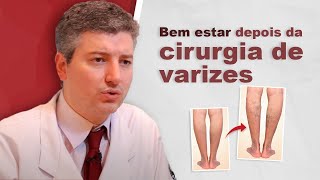 Bemestar depois da cirurgia de varizes a mudança dos sintomas após o tratamento [upl. by Yssirk11]