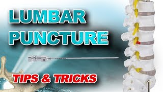 Lumbar Puncture Tips amp Tricks [upl. by Suilienroc]