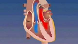 Transposition of the Great Arteries [upl. by Ulu]