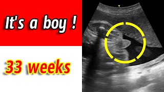 33 Weeks Ultrasound  Baby Boy [upl. by Minta]