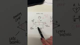 MURMUR MAN FOR CARDIAC MURMURS MNEMONIC [upl. by Nerrawed]