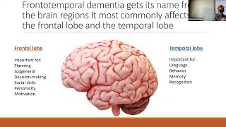 Frontotemporal Dementia What we know and what we want to know [upl. by Lrigybab]