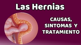 LAS HERNIAS Causas signos y síntomas diagnóstico y tratamiento [upl. by Screens47]