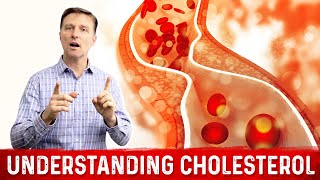 How to Read and Understand Your Cholesterol Levels [upl. by Brigitta]