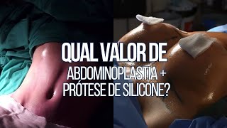 QUAL VALOR DE ABDOMINOPLASTIA COM PRÓTESE DE SILICONE  CIRURGIA PLÁSTICA [upl. by Naiviv]