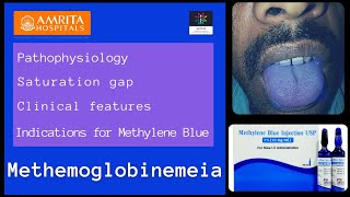 Methemoglobinemeia  Saturation gap  Methylene blue [upl. by Reich]