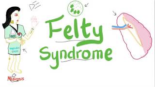 Felty Syndrome  The infamous Triad  Rheumatology [upl. by Panaggio795]