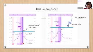 Tracking Your Basal Body Temperature  BBT Basics with Monica NFP Instructor [upl. by Lasko]