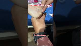 Cannula कैसे लगाए  cannulation  iv cannulation  cannula  intravenous cannulation  medical [upl. by Zoarah]