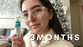 I Used Cerave Retinol for 3 Months  Photos  Update [upl. by Bergess941]