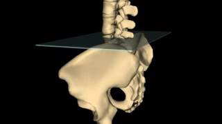 Anterior Innominate Rotation [upl. by Moyer761]